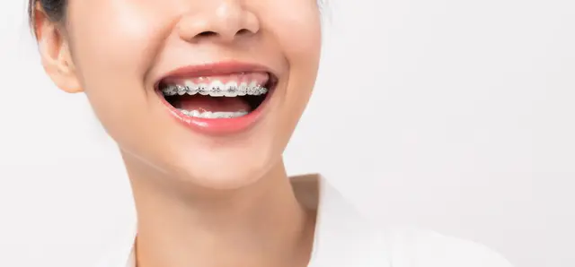 Orthodontics